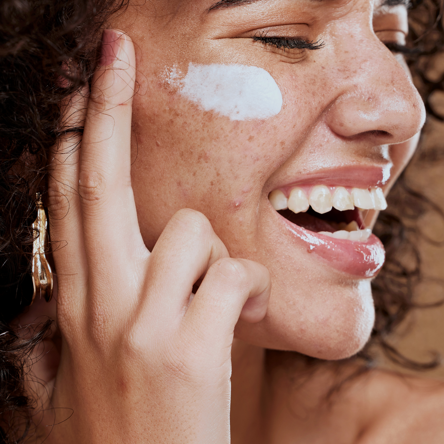 Acné & Acné hormonale