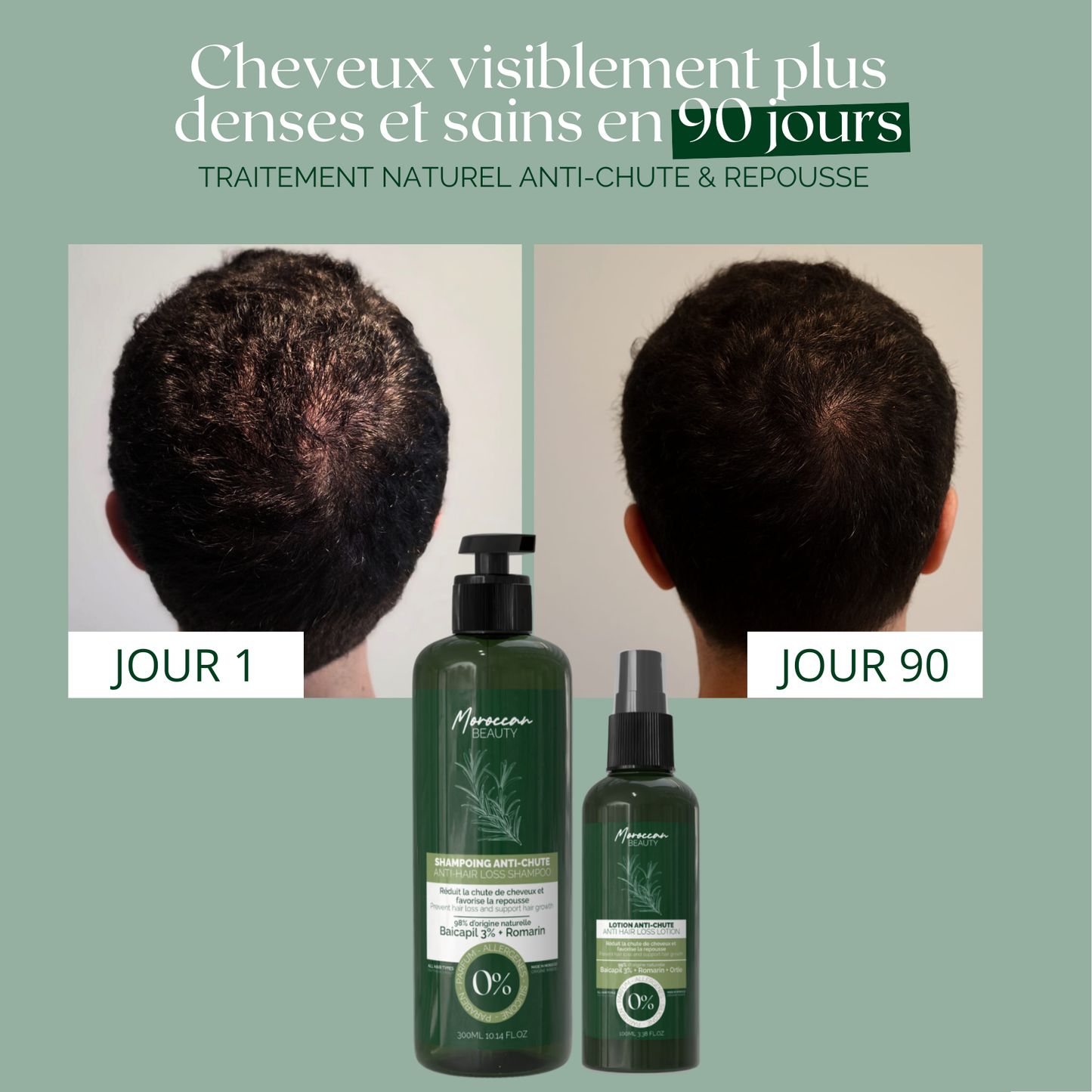 Duo Cure Naturelle Anti-Chute & Repousse – Shampoing 300ml & Lotion 100ml – Cure 90 Jours