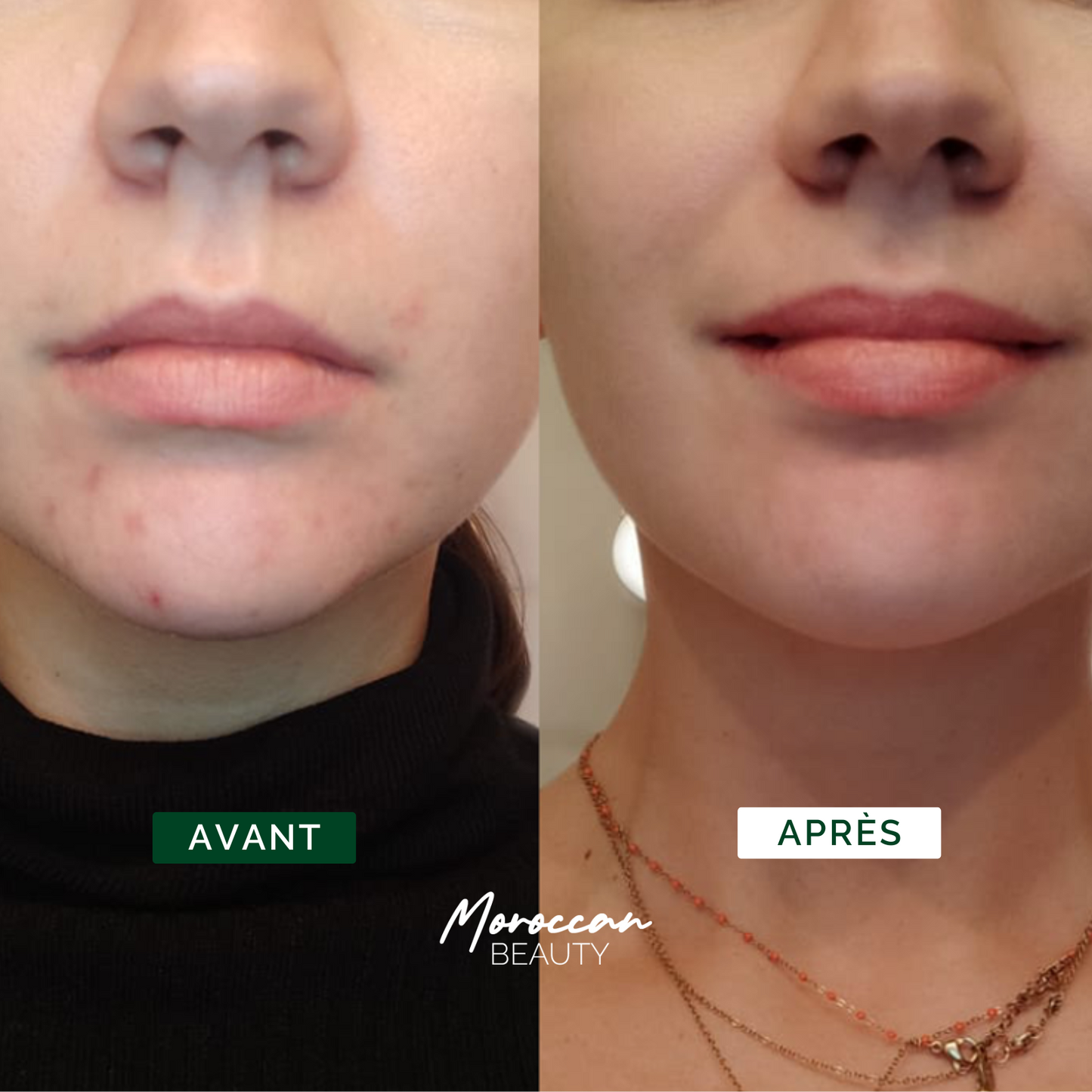 Routine Nour - Peau nette