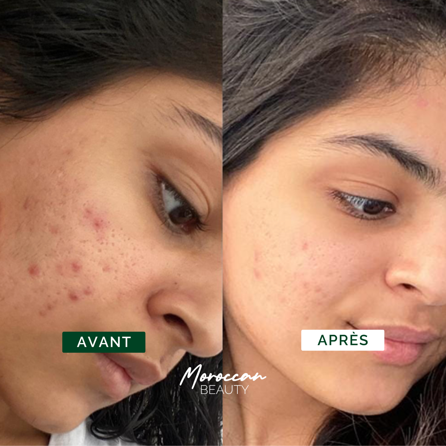 Routine Nour - Peau nette