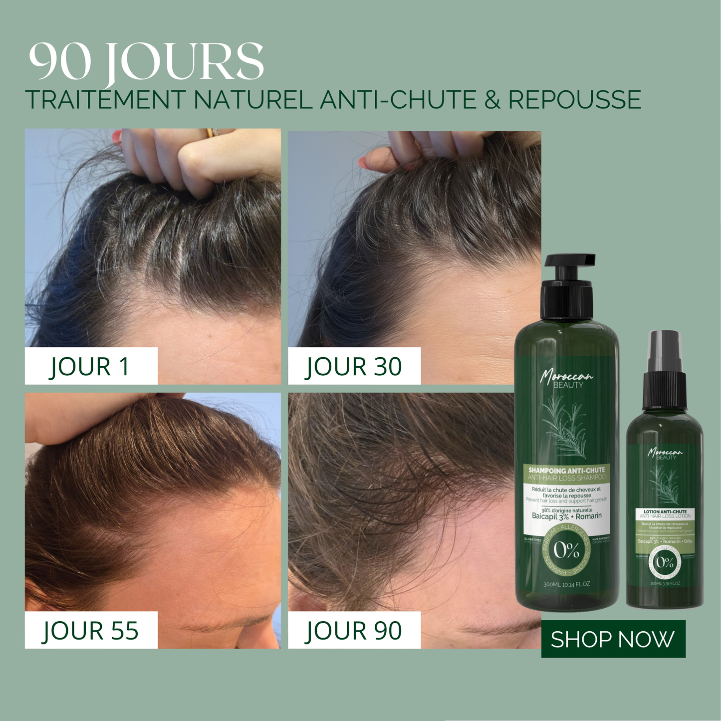 Duo Cure Naturelle Anti-Chute & Repousse – Shampoing 300ml & Lotion 100ml – Cure 90 Jours